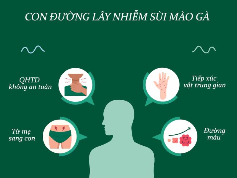 Sùi mào gà chủ yếu lây qua quan hệ tình dục và tiếp xúc trực tiếp với vùng da nhiễm HPV.