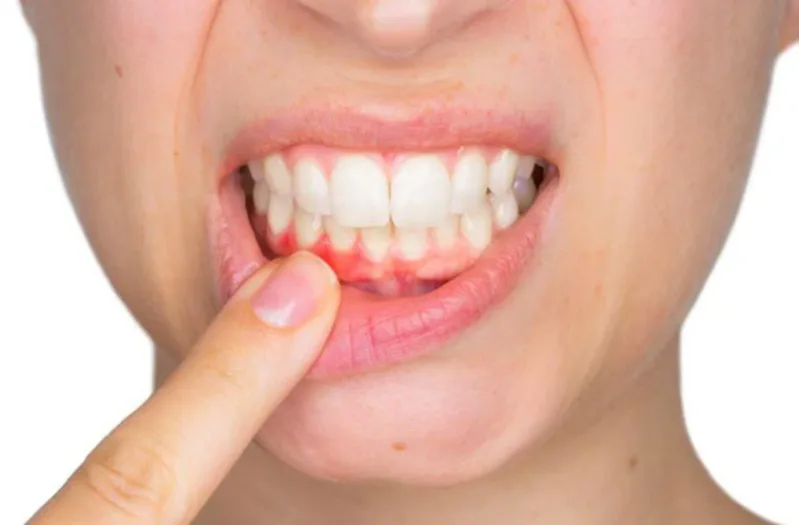 Các vấn đề răng miệng ngoài đời có thể khiến não bộ đưa hình ảnh răng vào giấc mơ.